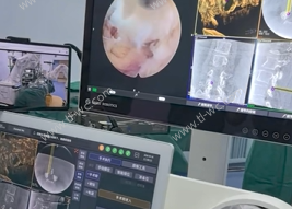 The spinal surgery robot has been released